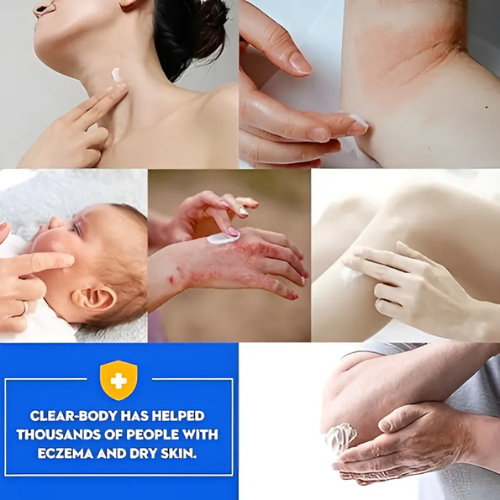 Natural Eczema Relief Cream™